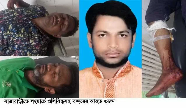 যাত্রাবাড়ীতে বন্দরের একজন গুলিবিদ্ধসহ ৩জন মিটফোর্ডে ভর্তি
