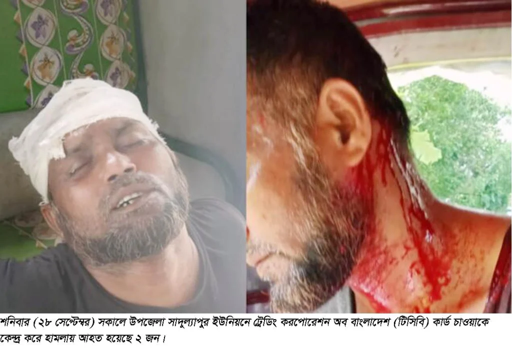 মতলব উত্তরে টিসিবির কার্ড নিয়ে সংঘর্ষে আহত ২