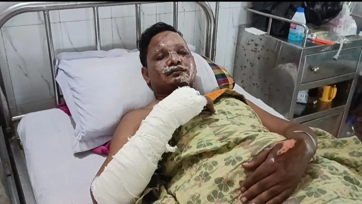 ফুলবাড়ীর গণিপুর গ্রামে আইনজীবীর বাড়ীতে অগ্নিসংযোগ দগ্ধ ২