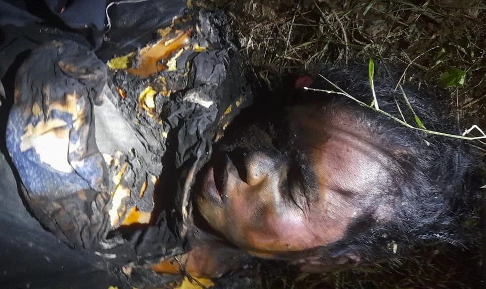 মতলব উত্তরে পানি নিষ্কাশনের  ড্রেন থেকে আগুনে পোড়া অজ্ঞাত নারীর লাশ উদ্ধার