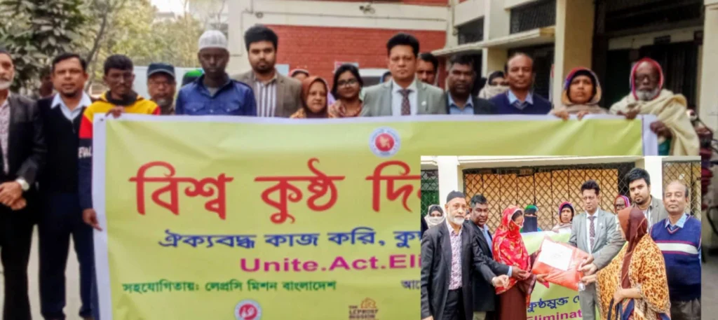 নানা কর্মসূচির মধ্য দিয়ে নারায়ণগঞ্জে বিশ্ব কুষ্ঠ দিবস পালিত 