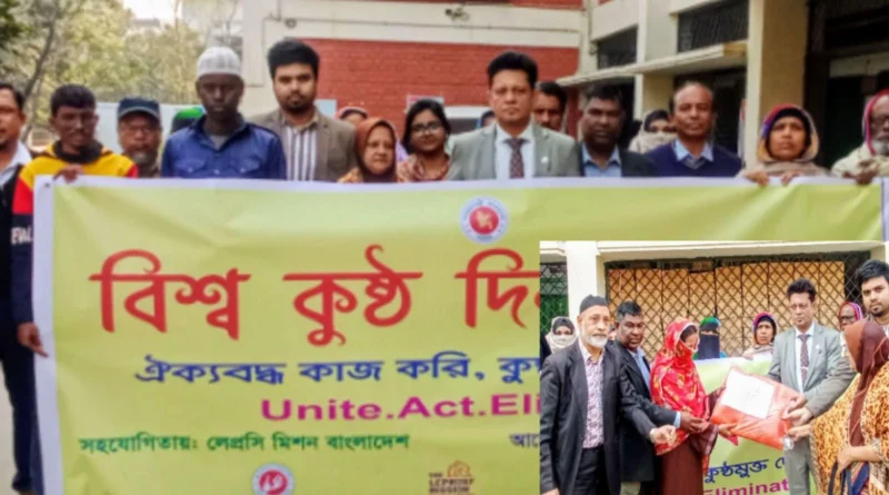 নানা কর্মসূচির মধ্য দিয়ে নারায়ণগঞ্জে বিশ্ব কুষ্ঠ দিবস পালিত 