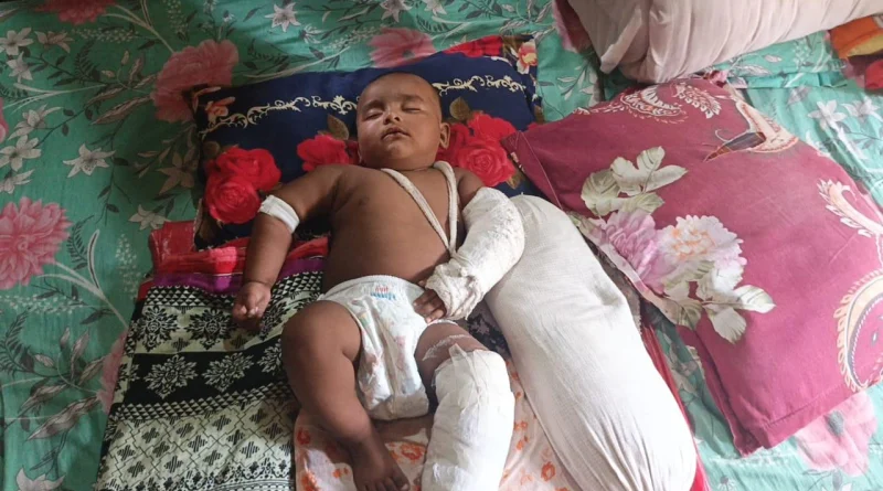 সোনারগাঁয়ে শিশুসন্তানের হাত-পা ভেঙ্গে পালিয়েছে গর্ভধারিণী মা