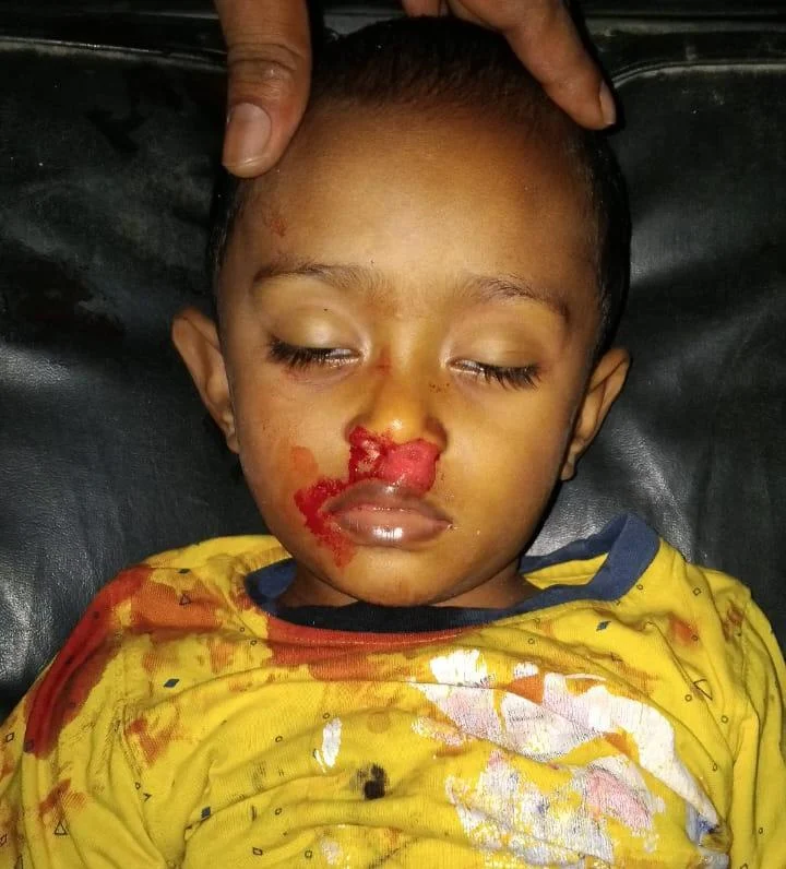 মায়ের চোখের সামনে ঘাতক অটোরিকশা কেড়ে নিল ৩ বছরের জিহাদের প্রাণ!