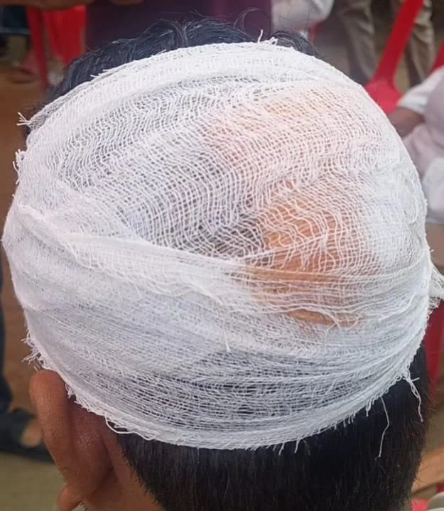 চাঁদার দাবিতে হিন্দু সম্প্রদায়ের বিয়ে বাড়িতে কিশোর গ্যাং হামলা, আহত ৩